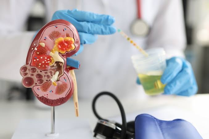 Parliament Panel Calls For Mandatory Kidney Tests From Age 20: A Major Push For Early Detection And Prevention